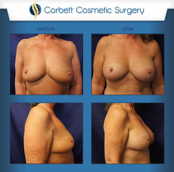 Corbett Cosmetic Surgery