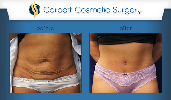 Corbett Cosmetic Surgery