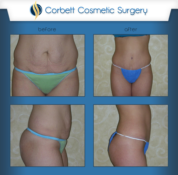 Corbett Cosmetic Surgery